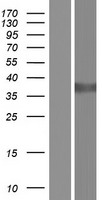 DDH / AKR1C1 Protein - Western validation with an anti-DDK antibody * L: Control HEK293 lysate R: Over-expression lysate