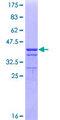 DDH / AKR1C1 Protein - 12.5% SDS-PAGE Stained with Coomassie Blue.