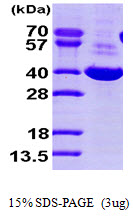 DDH / AKR1C1 Protein