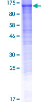 DDHD1 Protein - 12.5% SDS-PAGE of human DDHD1 stained with Coomassie Blue