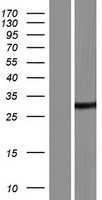 DDHD2 Protein - Western validation with an anti-DDK antibody * L: Control HEK293 lysate R: Over-expression lysate