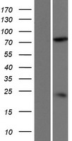 DDHD2 Protein - Western validation with an anti-DDK antibody * L: Control HEK293 lysate R: Over-expression lysate