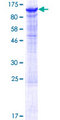 DDHD2 Protein - 12.5% SDS-PAGE of human DDHD2 stained with Coomassie Blue