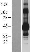 DDI1 Protein - Western validation with an anti-DDK antibody * L: Control HEK293 lysate R: Over-expression lysate