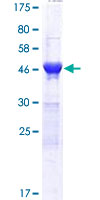 DDI2 Protein - 12.5% SDS-PAGE of human DDI2 stained with Coomassie Blue
