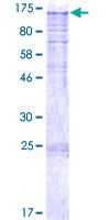 DDIAS Protein - 12.5% SDS-PAGE of human C11orf82 stained with Coomassie Blue