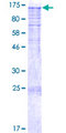 DDIAS Protein - 12.5% SDS-PAGE of human C11orf82 stained with Coomassie Blue