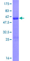 DDIT3 / CHOP Protein - 12.5% SDS-PAGE of human DDIT3 stained with Coomassie Blue
