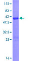 DDIT3 / CHOP Protein - 12.5% SDS-PAGE of human DDIT3 stained with Coomassie Blue
