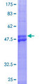 DDIT4 / REDD1 Protein - 12.5% SDS-PAGE of human DDIT4 stained with Coomassie Blue