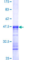 DDIT4 / REDD1 Protein - 12.5% SDS-PAGE Stained with Coomassie Blue.