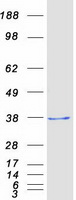 DDIT4 / REDD1 Protein - Purified recombinant protein DDIT4 was analyzed by SDS-PAGE gel and Coomassie Blue Staining