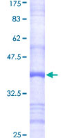 DDOST / OST48 Protein - 12.5% SDS-PAGE Stained with Coomassie Blue.