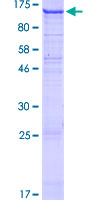 DDR2 Protein - 12.5% SDS-PAGE of human DDR2 stained with Coomassie Blue
