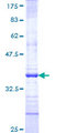 DDR2 Protein - 12.5% SDS-PAGE Stained with Coomassie Blue.
