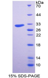 DDR2 Protein - Recombinant  Discoidin Domain Receptor Family, Member 2 By SDS-PAGE