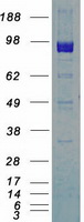 DDR2 Protein - Purified recombinant protein DDR2 was analyzed by SDS-PAGE gel and Coomassie Blue Staining