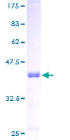 DDT / Dopamine Tautomerase Protein - 12.5% SDS-PAGE of human DDT stained with Coomassie Blue