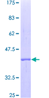 DDT / Dopamine Tautomerase Protein - 12.5% SDS-PAGE of human DDT stained with Coomassie Blue
