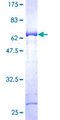 DDX / AKR1C3 Protein - 12.5% SDS-PAGE of human AKR1C3 stained with Coomassie Blue