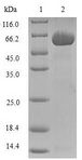 DDX / AKR1C3 Protein - (Tris-Glycine gel) Discontinuous SDS-PAGE (reduced) with 5% enrichment gel and 15% separation gel.