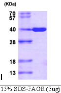 DDX / AKR1C3 Protein