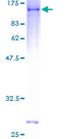 DDX1 Protein - 12.5% SDS-PAGE of human DDX1 stained with Coomassie Blue