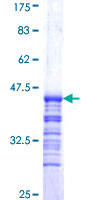 DDX1 Protein - 12.5% SDS-PAGE Stained with Coomassie Blue.