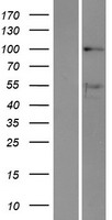 DDX10 Protein - Western validation with an anti-DDK antibody * L: Control HEK293 lysate R: Over-expression lysate