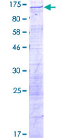 DDX10 Protein - 12.5% SDS-PAGE of human DDX10 stained with Coomassie Blue