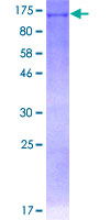 DDX11 / CHLR1 Protein - 12.5% SDS-PAGE of human DDX11 stained with Coomassie Blue