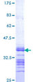 DDX11 / CHLR1 Protein - 12.5% SDS-PAGE Stained with Coomassie Blue