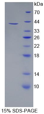 DDX11 / CHLR1 Protein - Recombinant  Cell Adhesion Molecule With Homology To L1CAM By SDS-PAGE