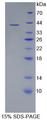 DDX11 / CHLR1 Protein - Recombinant  Cell Adhesion Molecule With Homology To L1CAM By SDS-PAGE