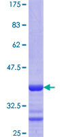 DDX17 Protein - 12.5% SDS-PAGE Stained with Coomassie Blue.