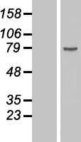 DDX18 Protein - Western validation with an anti-DDK antibody * L: Control HEK293 lysate R: Over-expression lysate