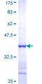 DDX18 Protein - 12.5% SDS-PAGE Stained with Coomassie Blue.