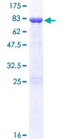 DDX19A Protein - 12.5% SDS-PAGE of human DDX19A stained with Coomassie Blue