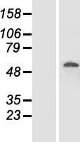 DDX19B Protein - Western validation with an anti-DDK antibody * L: Control HEK293 lysate R: Over-expression lysate