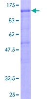 DDX20 / GEMIN3 Protein - 12.5% SDS-PAGE of human DDX20 stained with Coomassie Blue