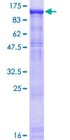 DDX20 / GEMIN3 Protein - 12.5% SDS-PAGE of human DDX20 stained with Coomassie Blue