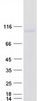 DDX20 / GEMIN3 Protein - Purified recombinant protein DDX20 was analyzed by SDS-PAGE gel and Coomassie Blue Staining
