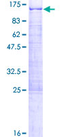 DDX21 Protein - 12.5% SDS-PAGE of human DDX21 stained with Coomassie Blue