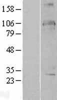 DDX24 Protein - Western validation with an anti-DDK antibody * L: Control HEK293 lysate R: Over-expression lysate