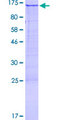 DDX24 Protein - 12.5% SDS-PAGE of human DDX24 stained with Coomassie Blue