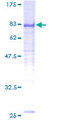 DDX25 Protein - 12.5% SDS-PAGE of human DDX25 stained with Coomassie Blue