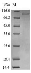 DDX3 / DDX3X Protein - (Tris-Glycine gel) Discontinuous SDS-PAGE (reduced) with 5% enrichment gel and 15% separation gel.