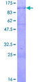 DDX3 / DDX3X Protein - 12.5% SDS-PAGE of human DDX3X stained with Coomassie Blue