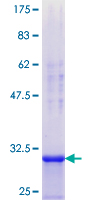 DDX3 / DDX3X Protein - 12.5% SDS-PAGE Stained with Coomassie Blue.