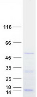 DDX39 Protein - Purified recombinant protein DDX39A was analyzed by SDS-PAGE gel and Coomassie Blue Staining